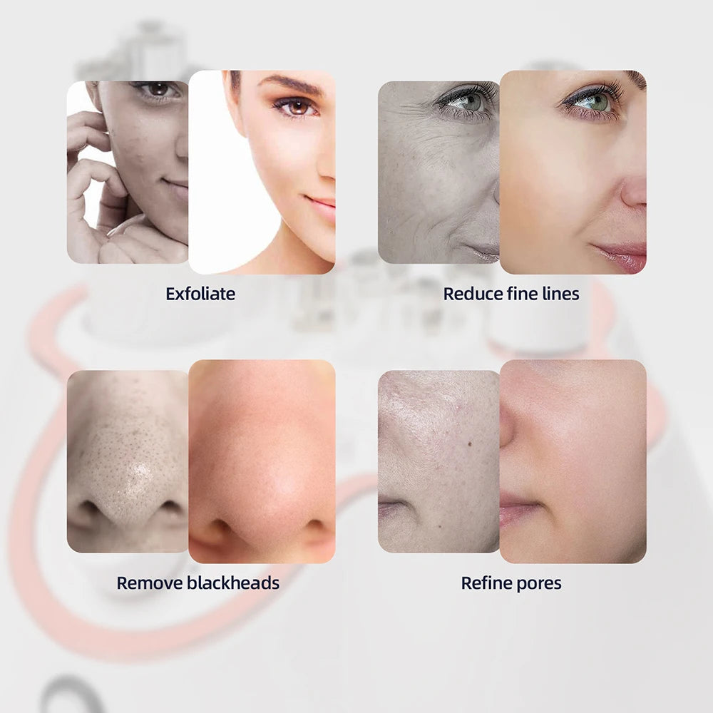 Diamond Microdermabrasion Facial Machine - Nano Water Spray